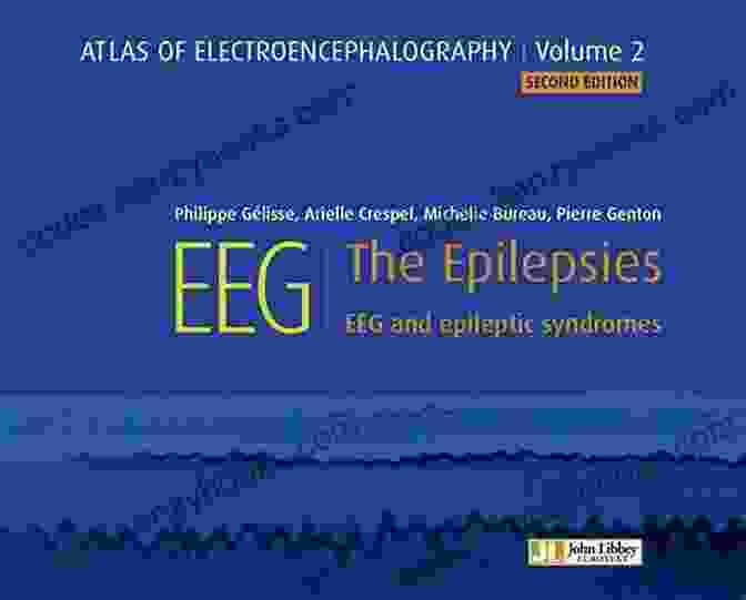 Eeg And Epileptic Syndromes Atlas Eeg Book EEG : The Epilepsies: EEG And Epileptic Syndromes (Atlas EEG 2)