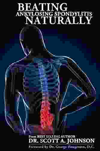 Beating Ankylosing Spondylitis Naturally Dr Scott A Johnson